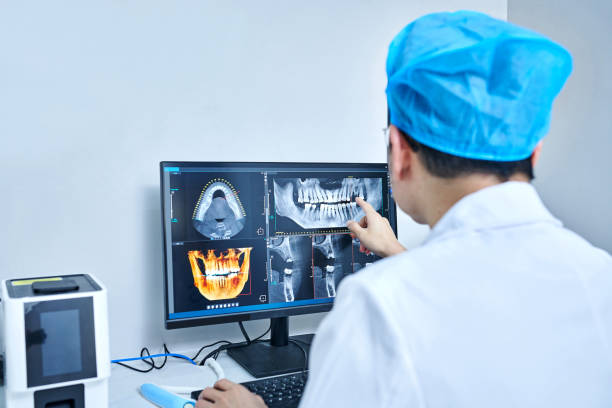Best Emergency Wisdom Teeth Removal in Spring Hill, TN